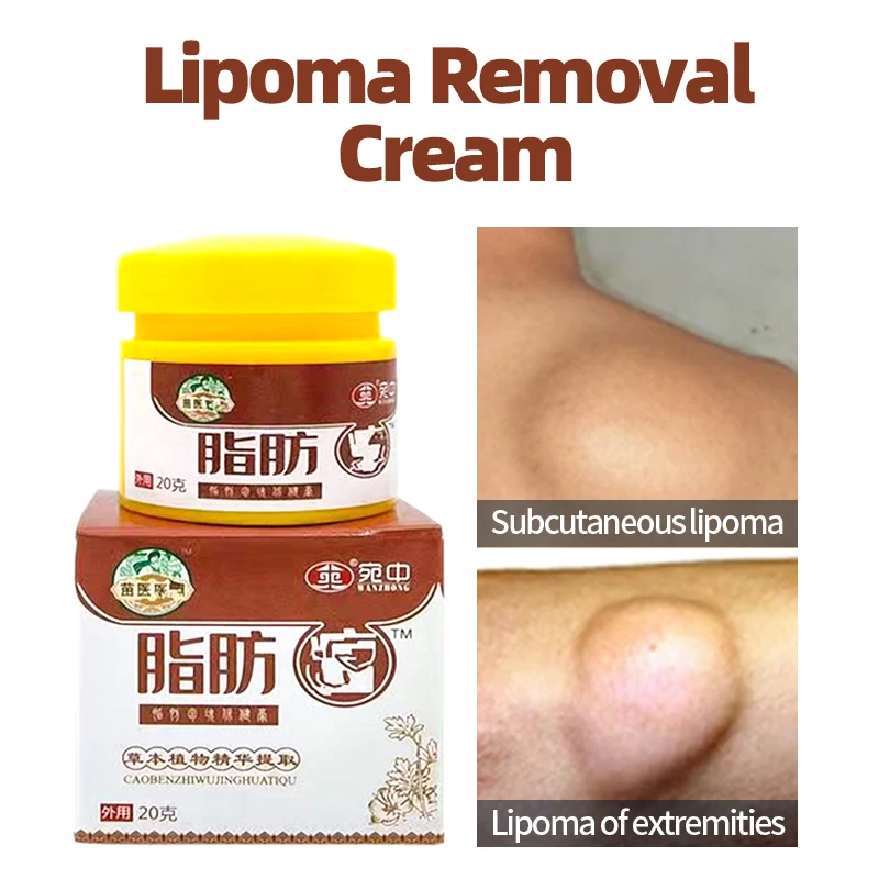 

Lipoma Remover Herbal Cream Subcutaneous Lumps Anti-Tumor Cellulite Fibroma Fat Mass Relief Skin Swelling Treatment Plaster