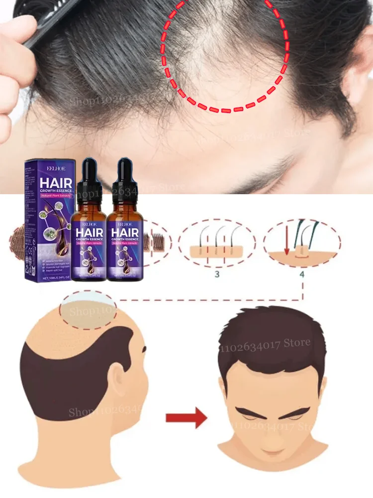 

Discover the Secret to Abundant Hair Growth