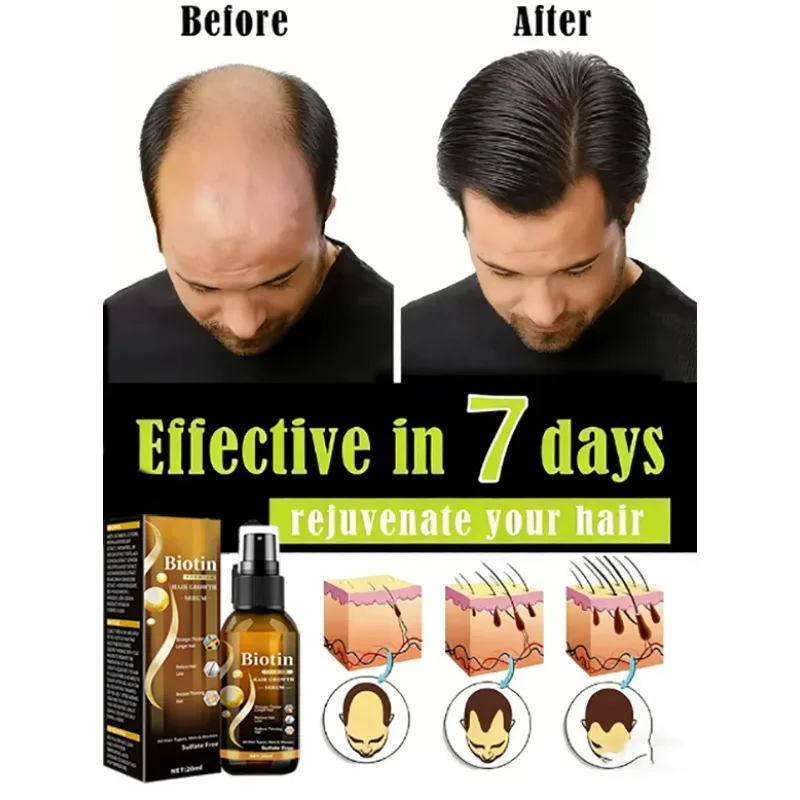 Say goodbye to hair loss and baldness anxiety, and effectively nourish your hair to keep it full and healthy.