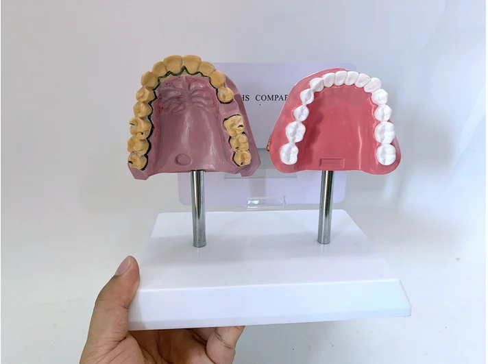 Health and Morbidity Human Smoking Tooth Comparative Anatomy Medical Education Teaching Model
