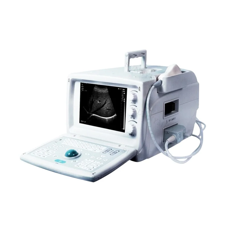 SY-A001 medical ultrasound instruments portable BW ultrasound scanner for human mobile pregnancy scanner ultrasound machine