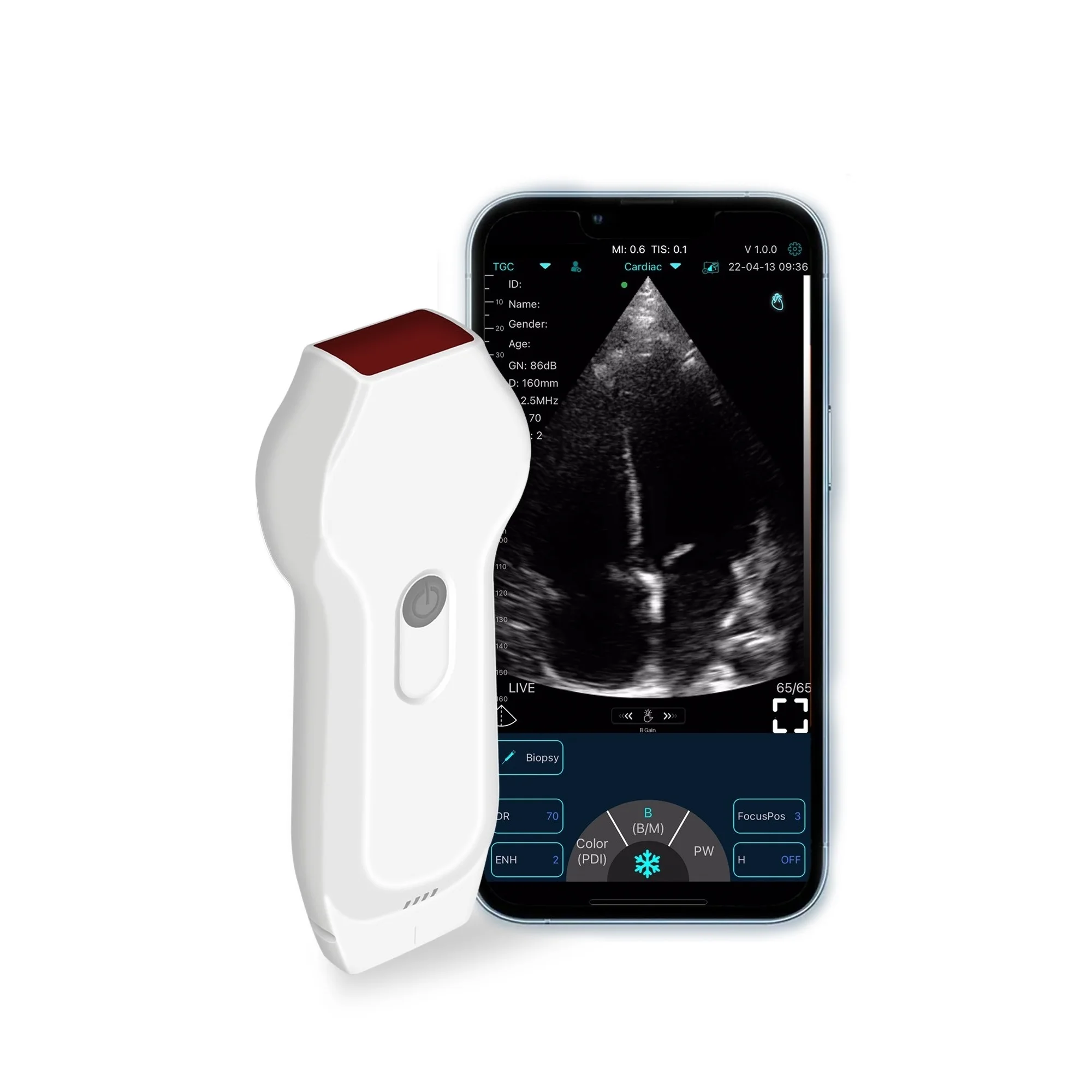 

Original brand newC10·XL D·oppler Portable Wifi&USB Wireless Ultrasound Linear&Cardiac dual-probe handheld Ultrasound