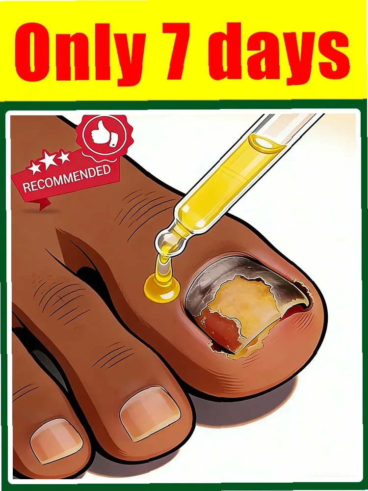 

Fast Penetrating Antifungal Nail Treatment - Clear & Healthy Nails in 2026
