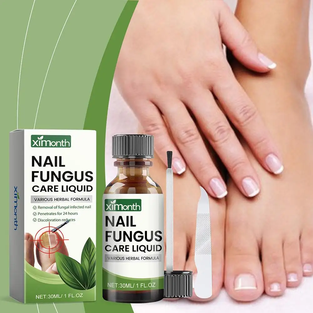 5 pièces onychomycose main pied élimination réparation soin ongles traitement fongique sérum Anti Infection orteil champignon Paronychia 50g