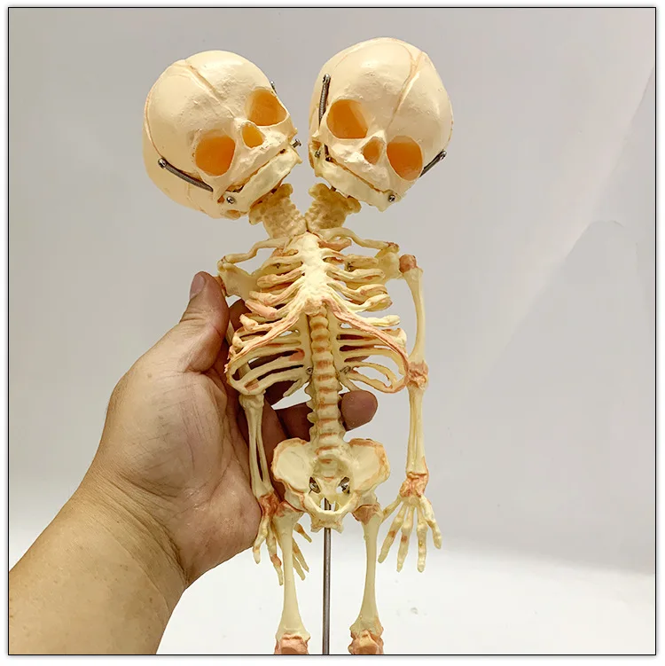 37cm Human Double Head Baby Skull Skeleton Anatomy Brain Display Study Teaching Anatomical Model Halloween Bar Ornament