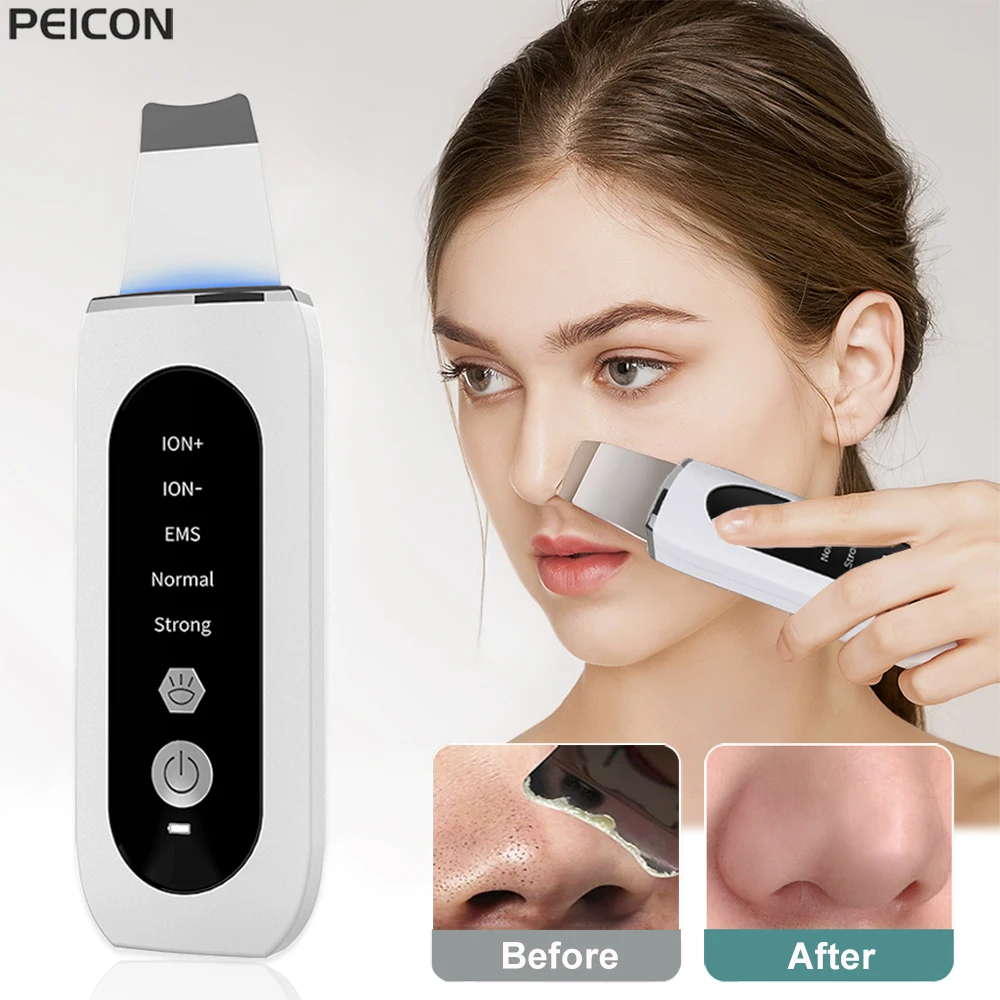 Ultrasonic Skin Scrubber Peeling Blackhead Remover ทำความสะอาดใบหน้า Ultrasonic Ion Acne Pore Cleaner พลั่ว Cleanser