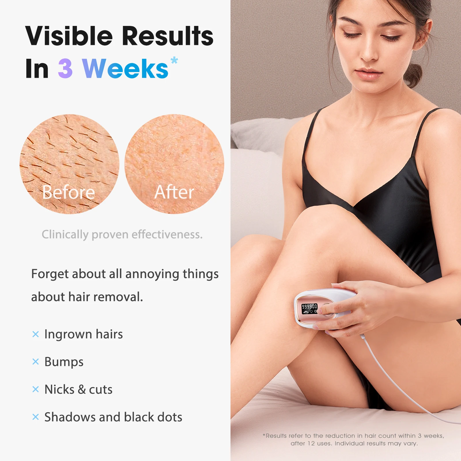 Thumbnail 4 - #21 Best IPL Devices to Buy In 2026