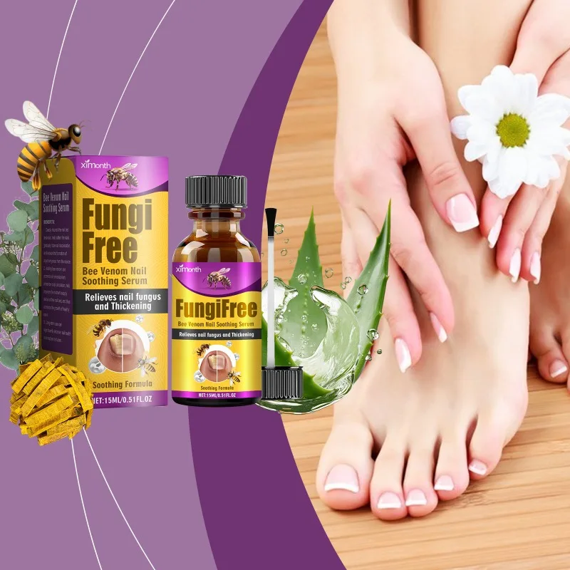 

15ml Nail Fungal Treatment Essential Oil Fungal Nail Renewal Anti Toe Infection Restores Appearance Removal Nail Fungal FootCare