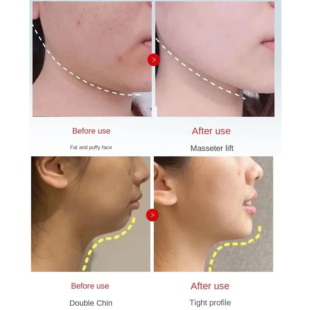 แผ่นมาส์กหน้ายกกระชับรูปตัววี 5 ชิ้น ช่วยยกกระชับผิว ลดเลือนริ้วรอยบริเวณคางและแก้ม