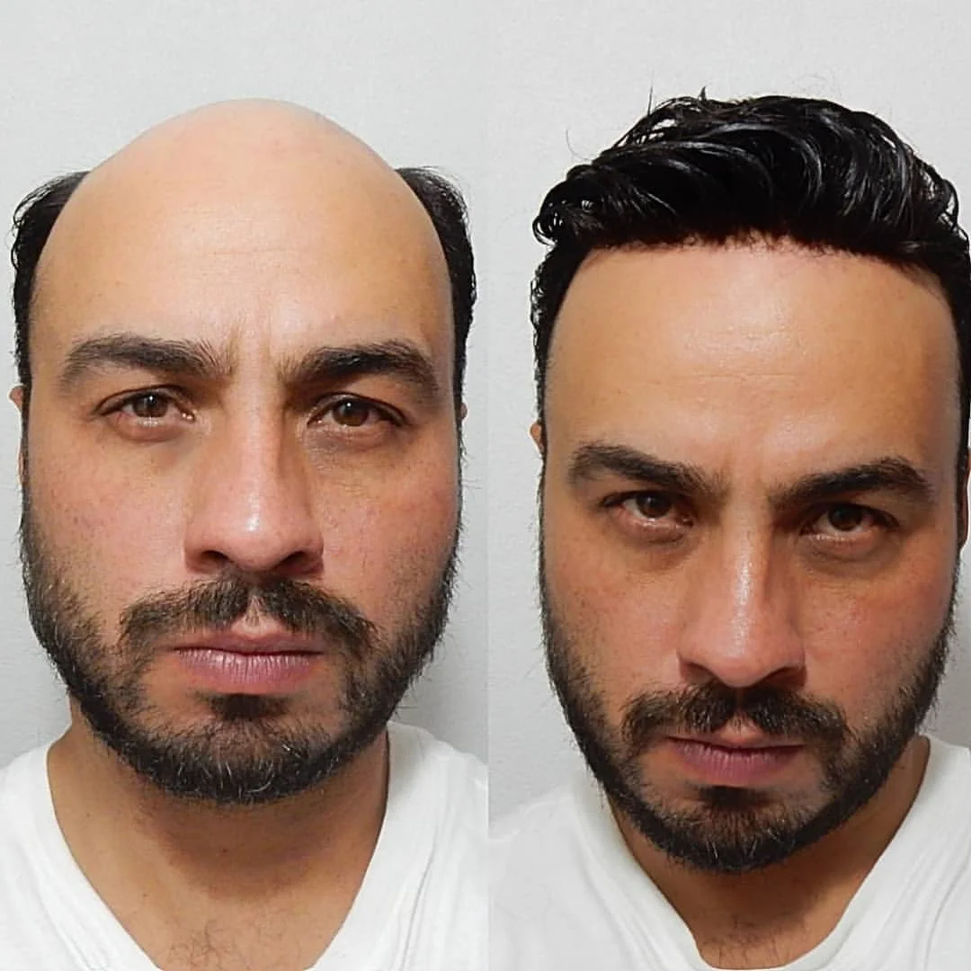NLW Toupee for Men Human Hair Replacement System