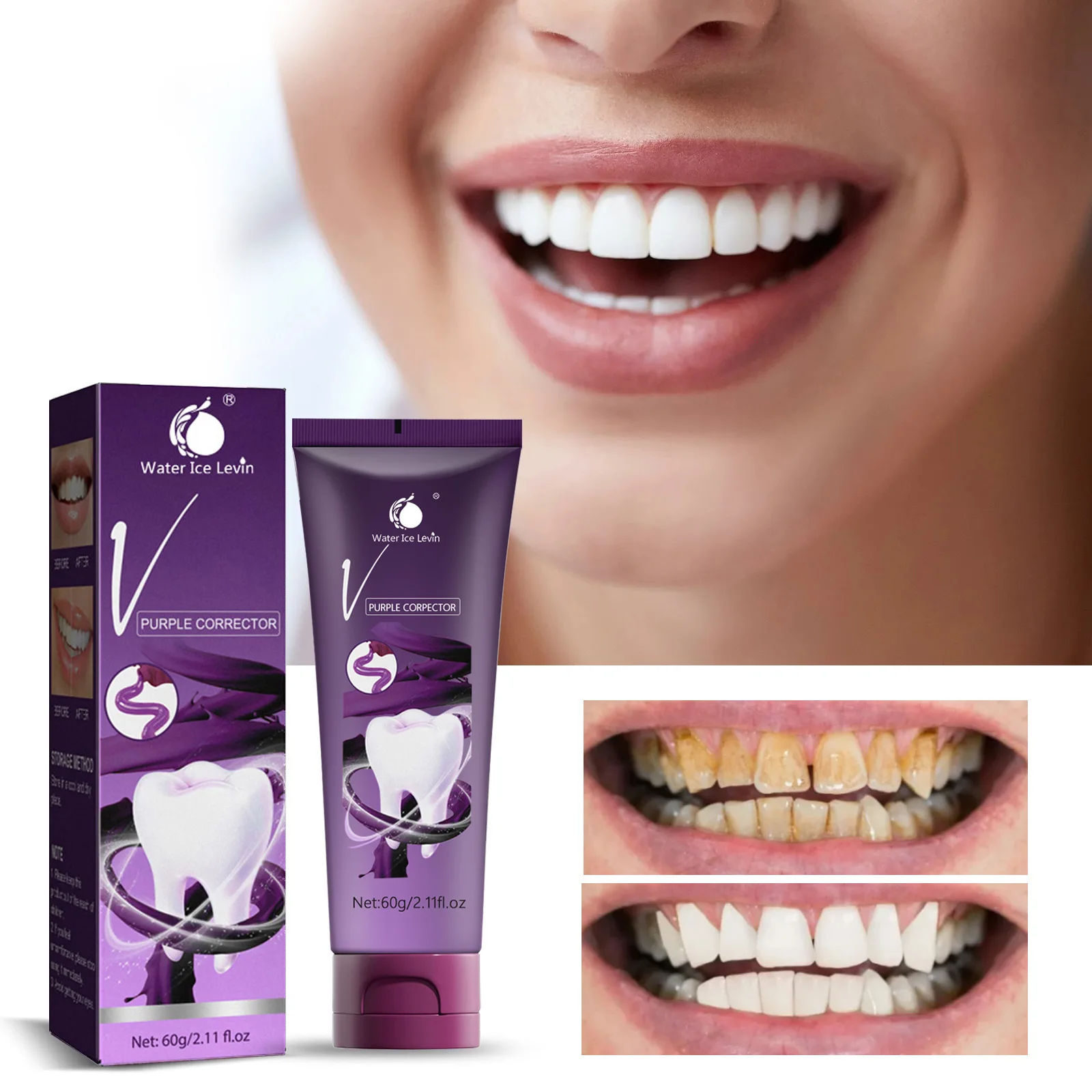 Tartar remover, bad breath removal, teeth whitening, toothpaste, whitening, periodontitis prevention, teeth cleaning care