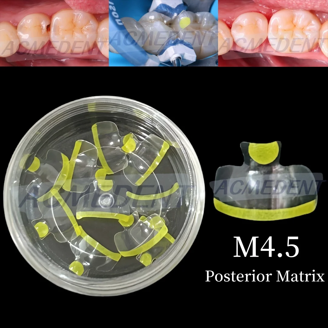 

Прозрачная матрица M4.5, стоматологические, задние, прозрачные матрицы BT Maxillary, контурные, аналог BioClear Matrice, черный треугольник