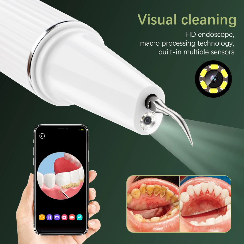 Electric Visual Ultrasonic Tooth Cleaner With Camera Dental Scaler Calculus Remover Irrigator Teeth Whitening Tartar Eliminator