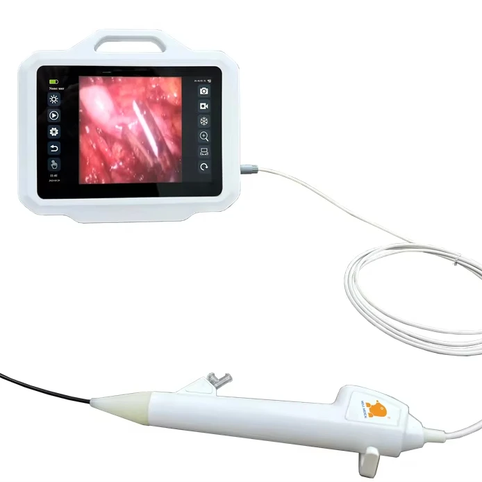 Ureteroscope New Type Endoscope Camera System Hysteroscopy Laparoscope Uroscope Disposable Urological Scope Urethrascope