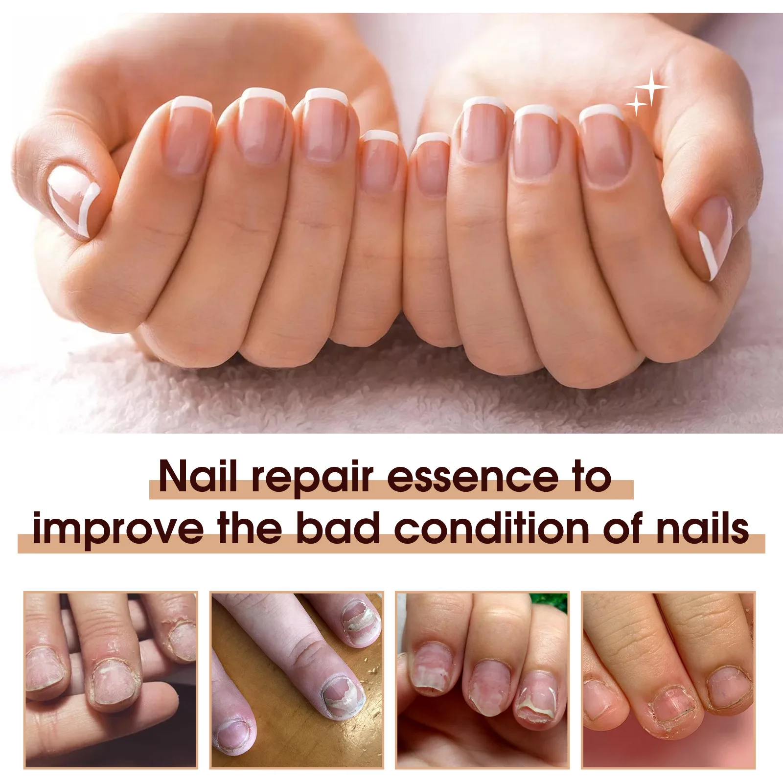 ครัวเรือนมือและเท้า Cutin Nail Essence