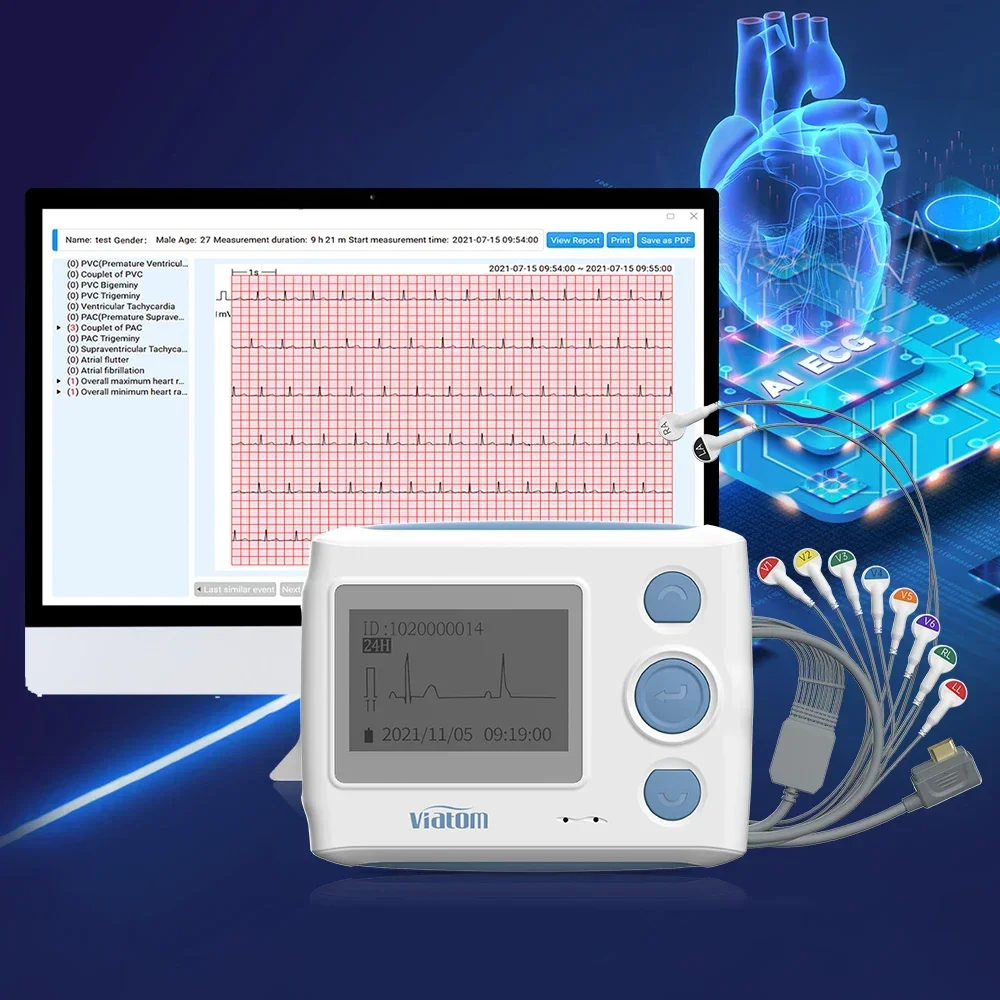 Viatom Th12 12-Kanal-Ekg-Kabelmaschine, tragbarer Mini-Holter-Monitor-Recorder, 12-Blei-Cardioline-EKG-Maschine, Elektrokardiograph