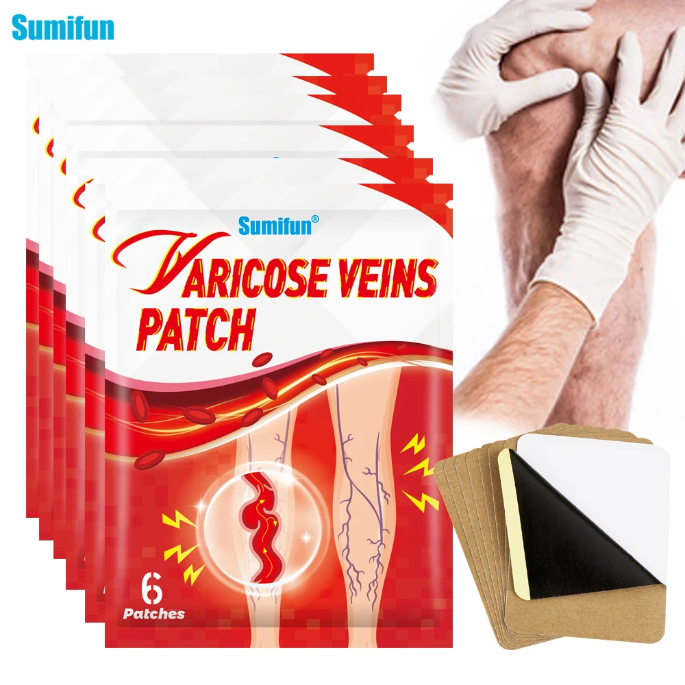 

6/30/60pcs Varicose Vein Patch Phlebitis Vasculitis Massage Sticker Varicosity Angiitis Spider Leg Medical Plaster Beauty Health