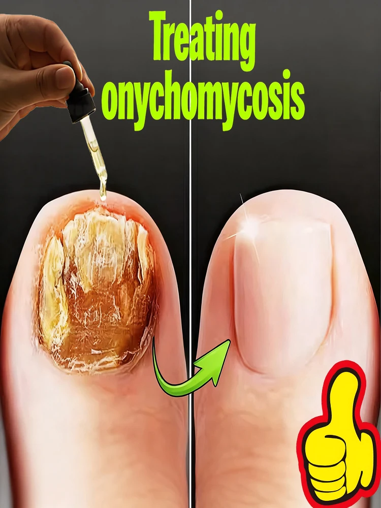 

Gentle penetration , restore natural radiance