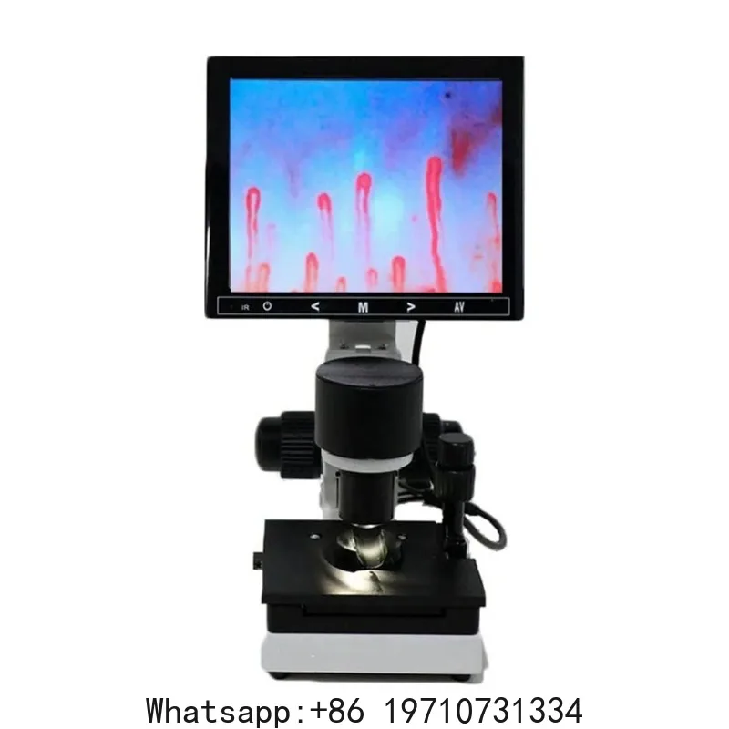 

Digital Microscope Zoom Nailfold Capillary Microcirculation Detector Blood Microcirculation Analyzer with 7/8/9" Digital Screen