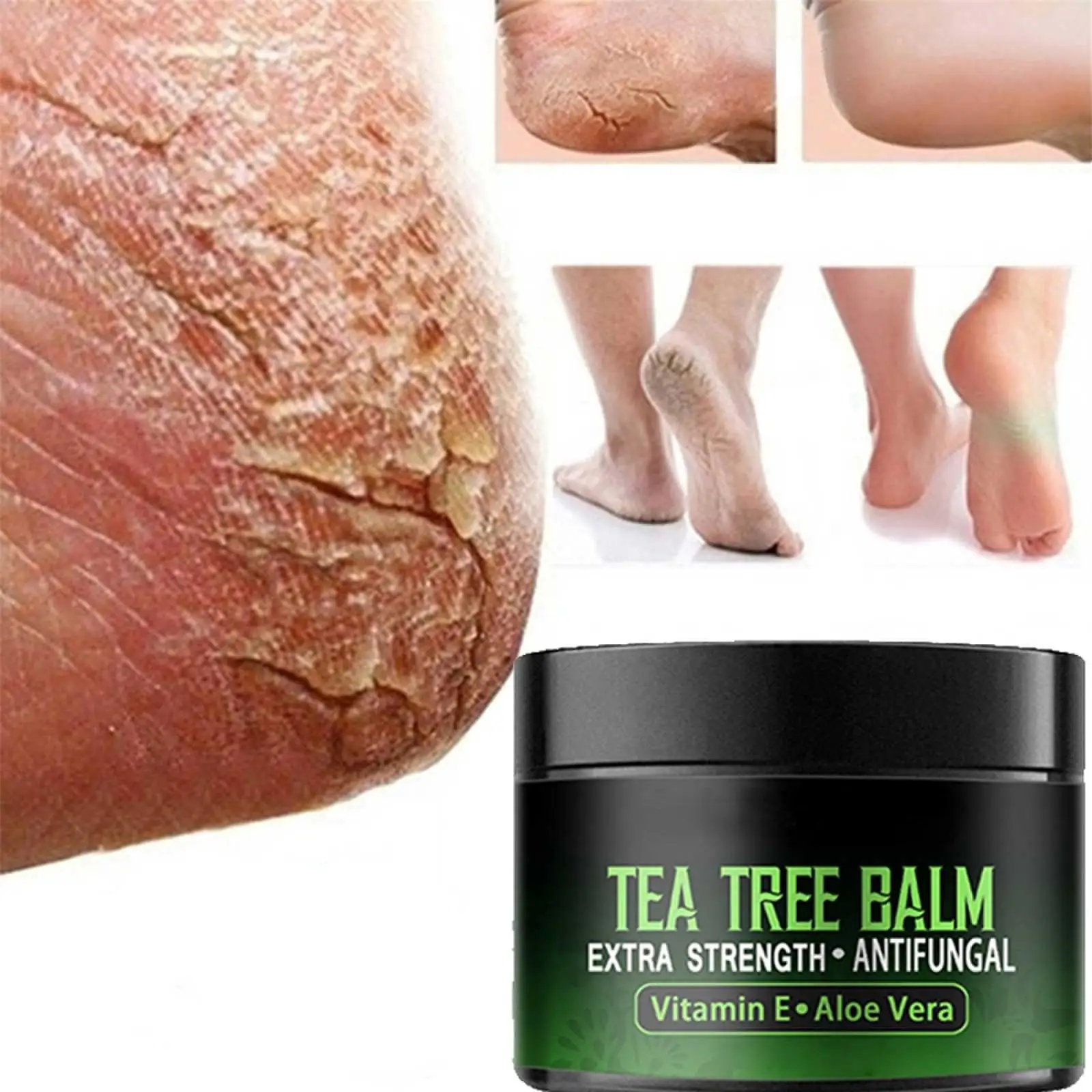 Anti-Drying Crack Foot Cream Heel Cracked Repair Cream Removal Dead Skin Hand Feet Care Hand and Foot Skin Care