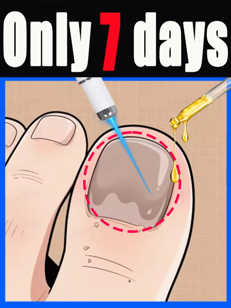 

UPgrade 5th foot Blue light pen 2026, может быть широко использован