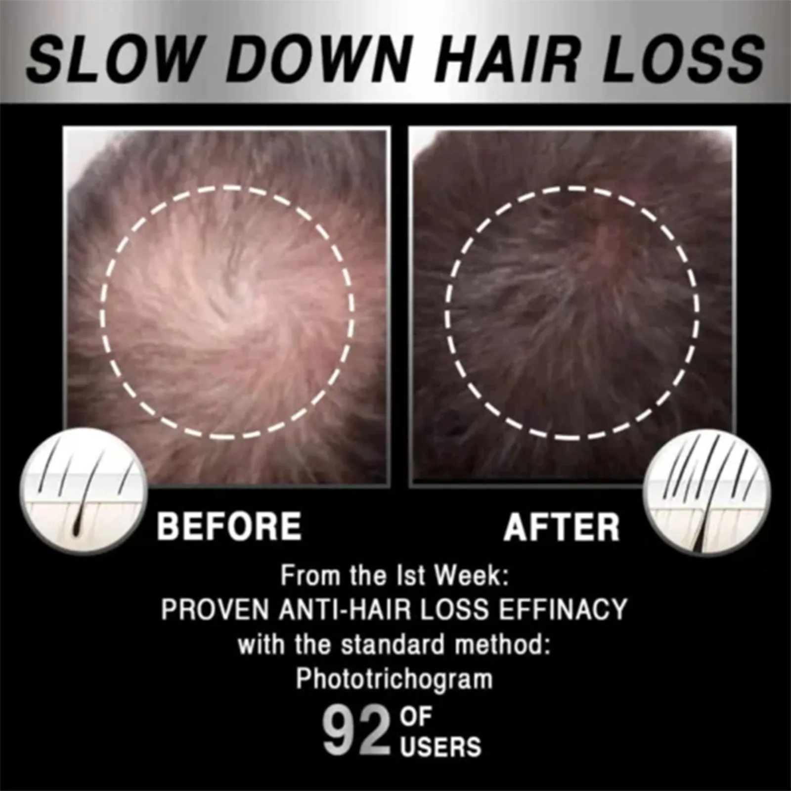 Hoegoa dense hair care cap 1PC soft dense hair scalp care heating massage cap mobile hair growth cap temperature adjustable