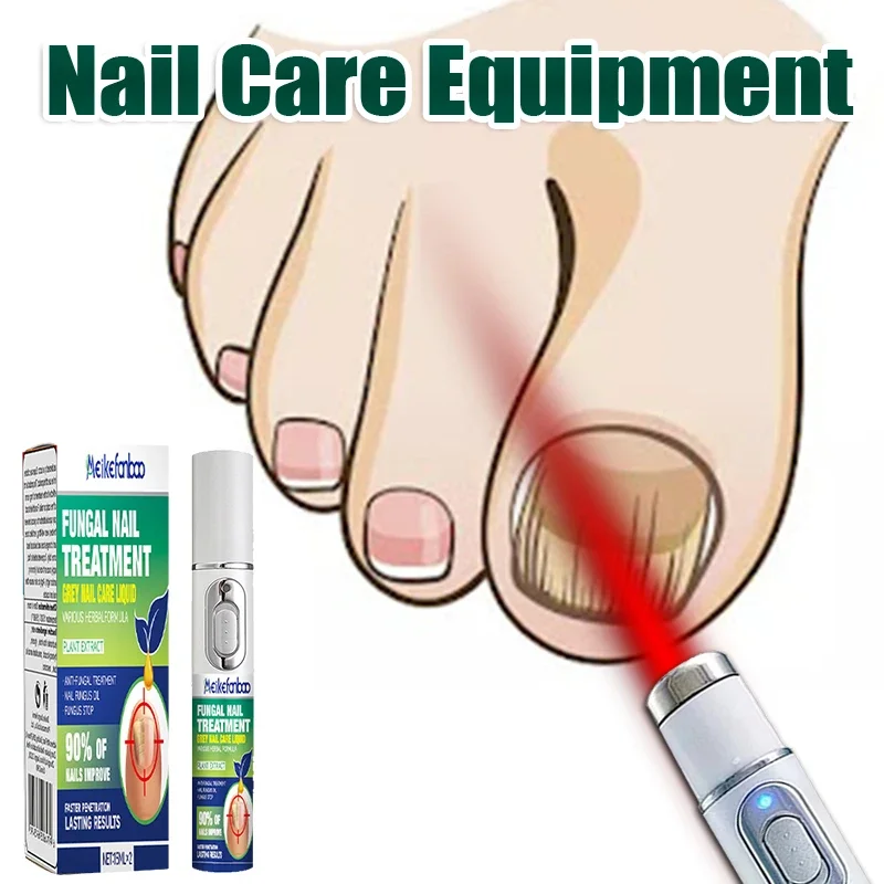 

Nail Fungus Laser Pen