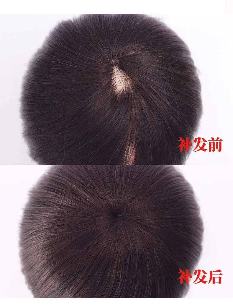 여성용 리얼 헤어 탑 헤어 패치 흰머리 커버용 헤어피스 볼륨 증가 인비저블 인모 패치 합성