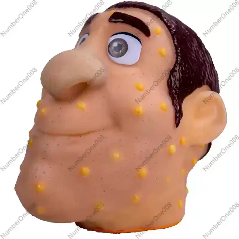 

Portable Stress Relief Squeeze Tool for Pimples and Blackheads