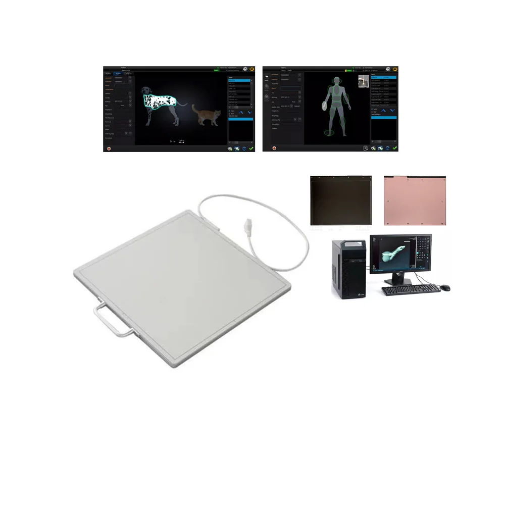 Portable Flat Panel X Ray Wired Wireless Dr Digital Flat Panel Detector 17*17 For Veterinary Or Human