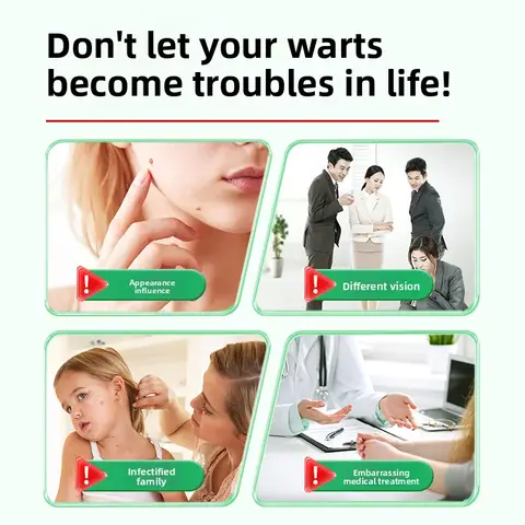 8 best sales removal - №7