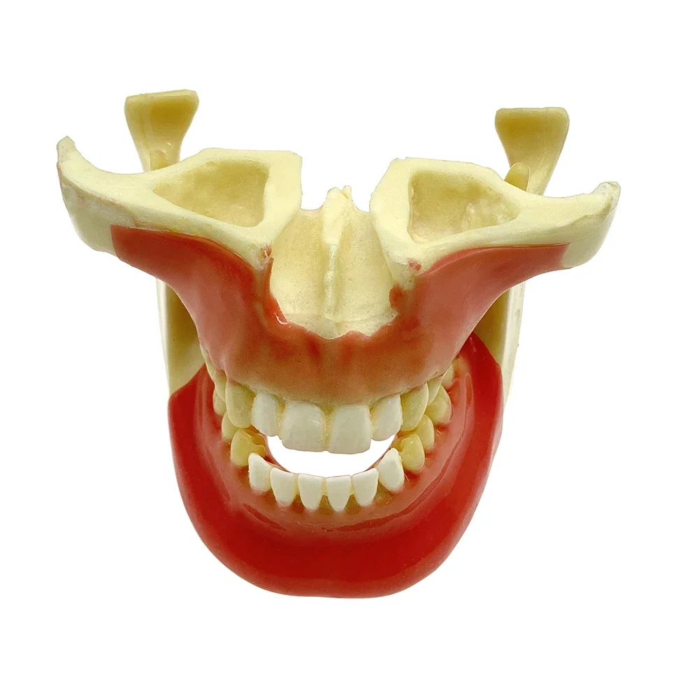 Dental Study Ortho implant Practice model Teaching exercise for Doctor student pathological demonstration teeth model