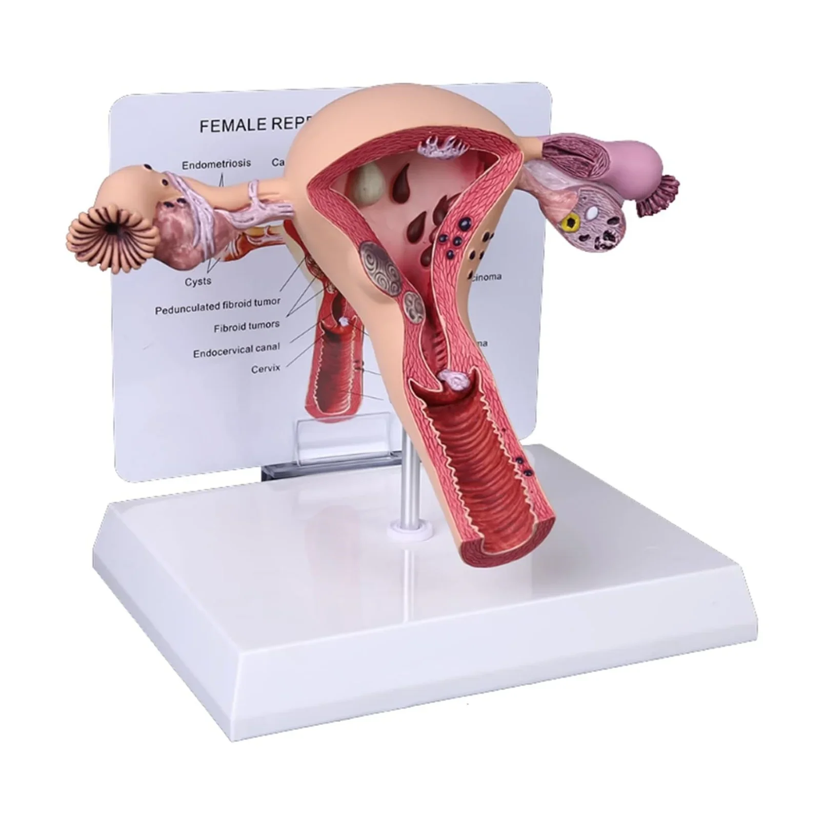 Anatomy Ovary Pathological Model Uterus Anatomical Model with Removable Organs for Doctors Office Tool Organs Model