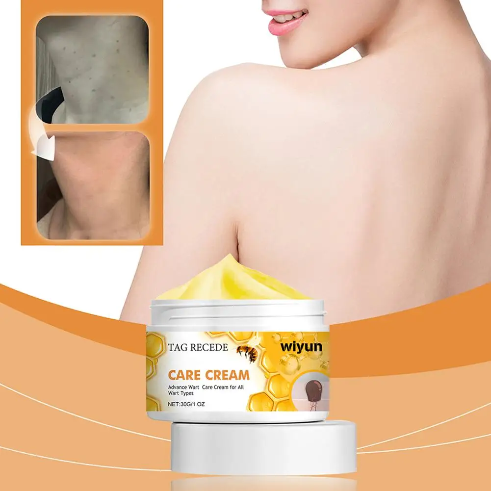 Crema para el cuidado de las articulaciones Venoms de abeja, 30g, alivia el dolor de las articulaciones cervicales, tratamientos de masaje, crema para la salud de los huesos, herramientas para el cuidado del cuerpo