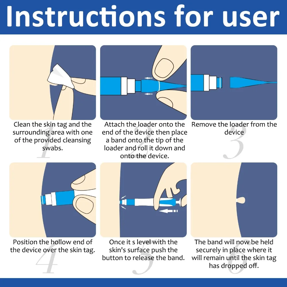 ชุดเครื่องมือกำจัดไฝ กำจัดสิว กำจัดหูด 2-IN-1 อัตโนมัติ ไม่เจ็บปวด ปากกากำจัดหูด กำจัดจุดด่างดำบนร่างกาย เครื่องมือดูแลผิวหน้า