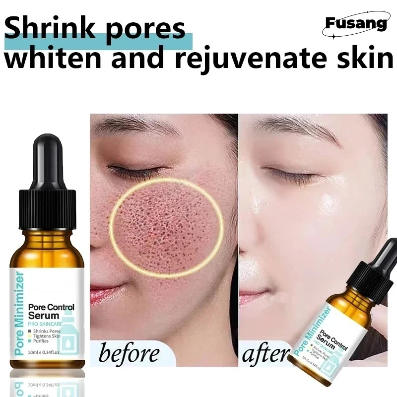 

Women Lightening Essence Pores Remove To Improve Coarse Pores Repair Greasy Tender Skin Moisturizing Essence Skin Care Beauty