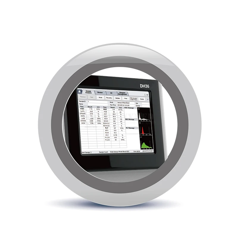 SYB-DH36 الطبيب البيطري DH36 عداد خلايا الدم محلل أمراض الدم التلقائي 3 جزء CBC آلة اختبار الدم
