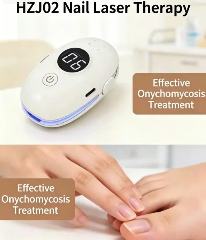 Nail Repair Machine for Onychomycosis Treatment – Advanced Laser Technology, No Side Effects, Easy to Use, Just 2x Daily 7-Min S