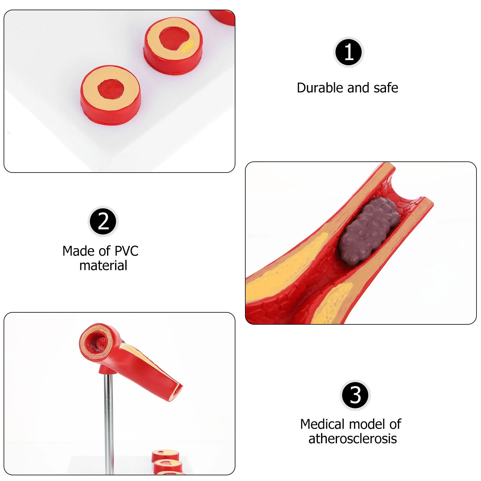 Vascular Model Atherosclerosis Display Human Anatomical Models Cardiovascular Teaching Vacuum