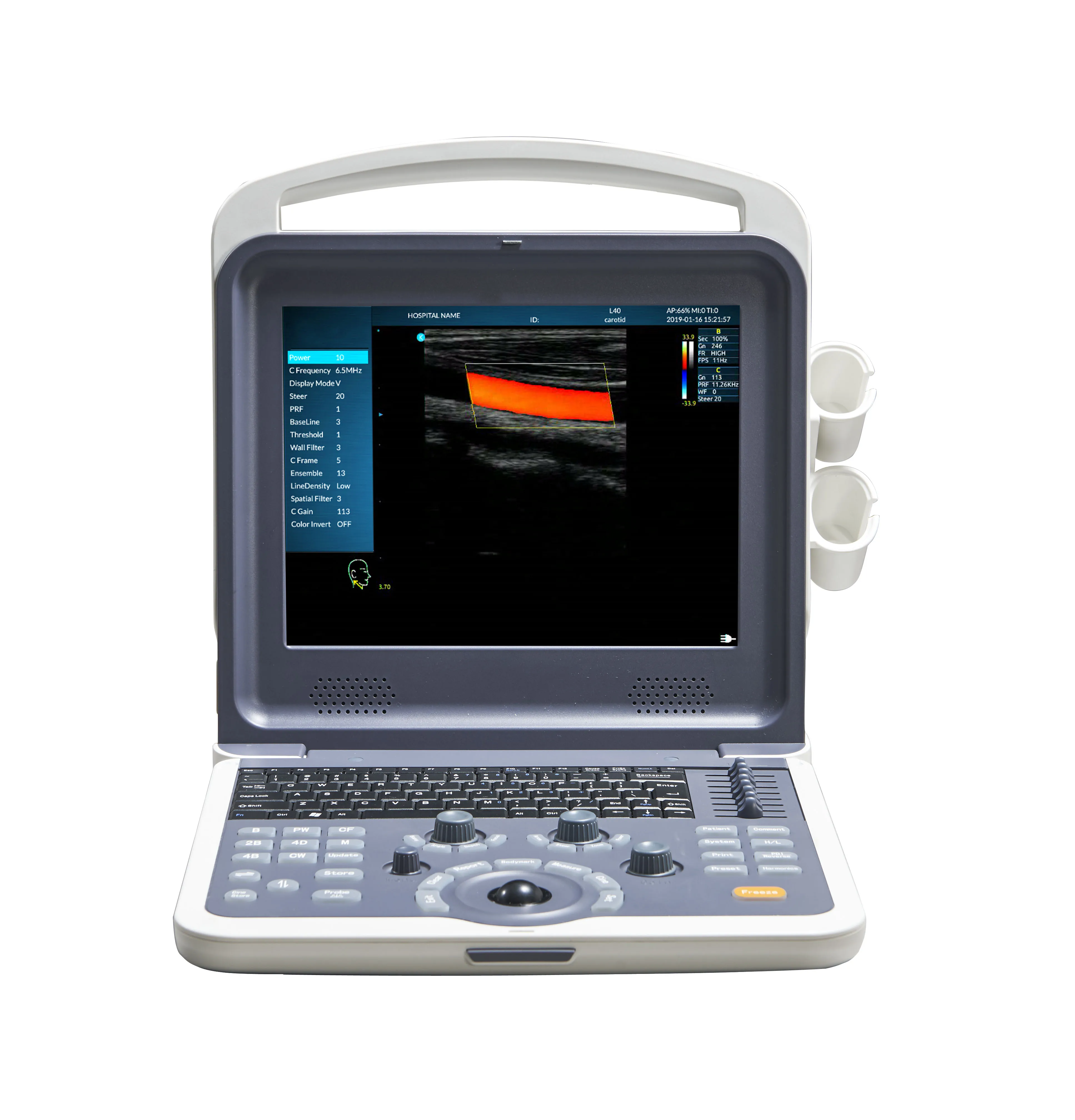 Cheapest Portable Laptop Color Doppler Ultrasound Machine MSLCU62 For Human And Veterinary