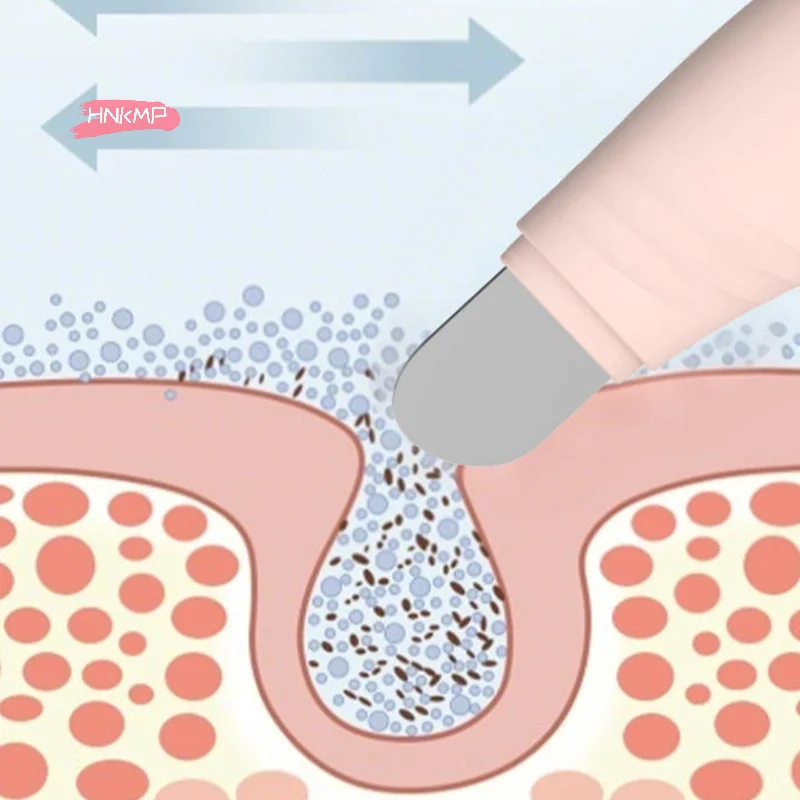أداة إزالة الرؤوس السوداء للوجه - ملعقة تنظيف عميق للعناية بالبشرة وإزالة الرؤوس البيضاء وحب الشباب ومكشطة الوجه للبشرة الواضحة #4