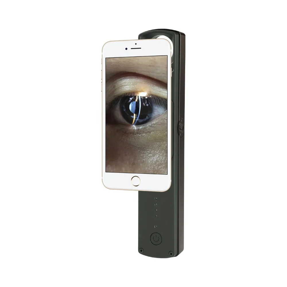 

Самая продаваемая цифровая оптическая щелевая лампа PortA/Ble S150D PortA/Ble Офтальмологическое оборудование Инструмент Оптические инструменты