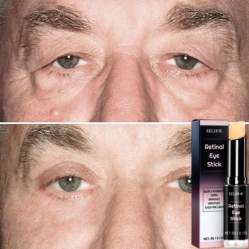 Crema per la rimozione istantanea delle borse per gli occhi Collagene Antirughe Dissolvenza Linee sottili Rassodante della pelle Anti occhiaie Gonfiore Illumina la cura degli occhi