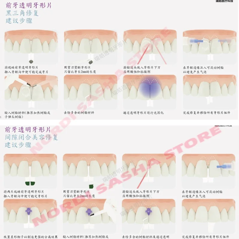 150Pcs/Set Dental Clear Anterior and Posterior Transparent Matrix Trial Kit Dentistry BioClear BT Black Triangle Matrices Wedges