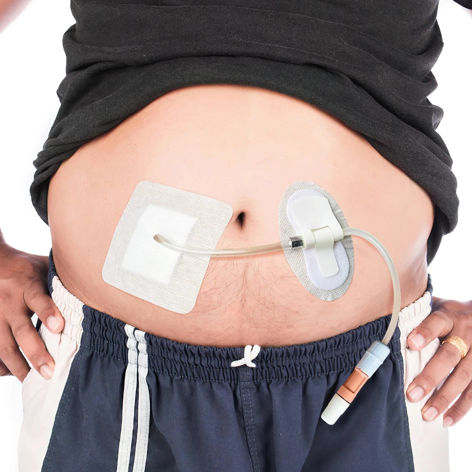 20 قطعة أجهزة تثبيت الأنبوب أصحاب القسطرة الطبية قبضة قوية التفاف لليد القدم سهلة تطبيق حزام الساق #2