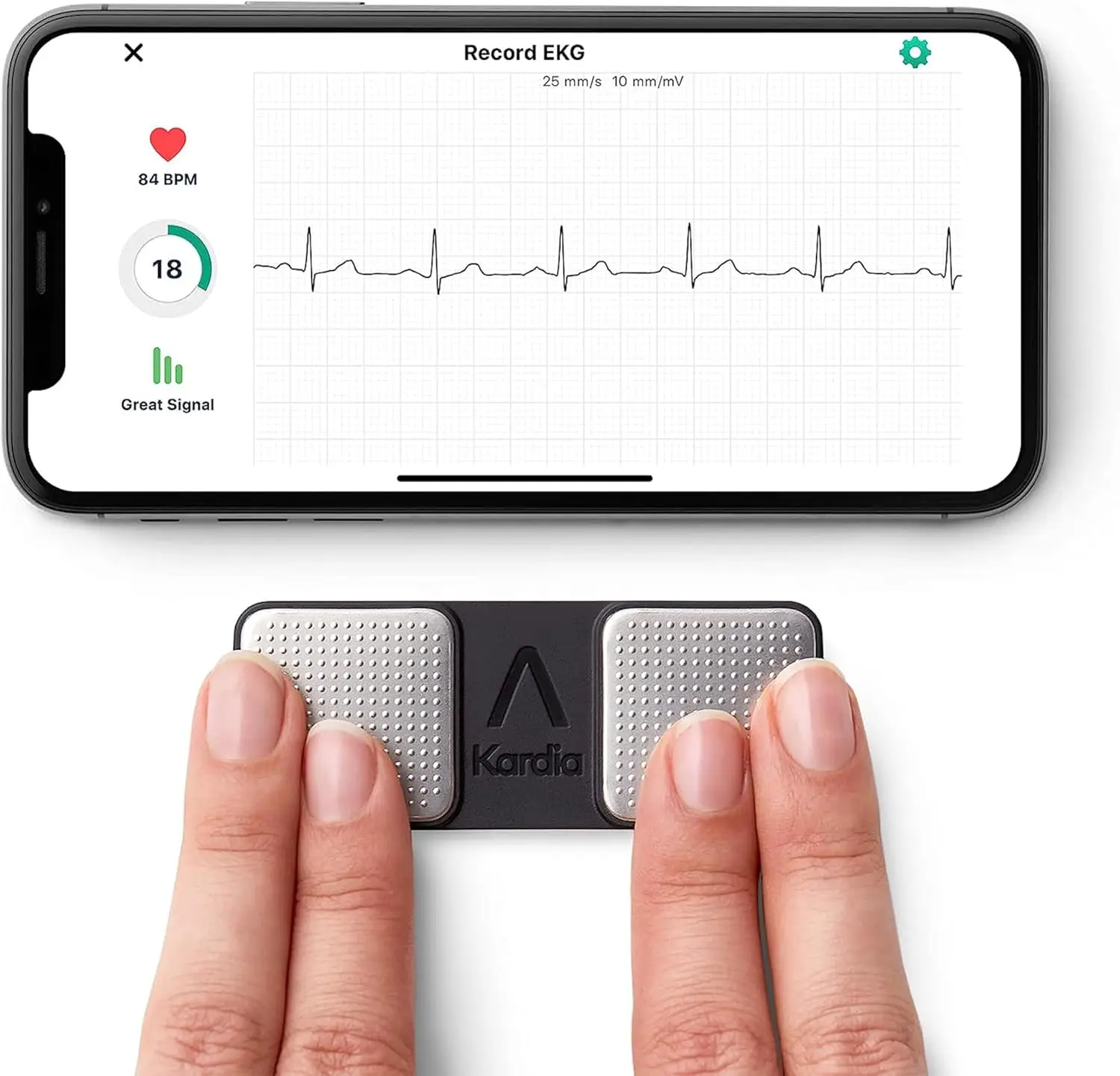 KardiaMobile 1L ECG Portátil | Individua Fibrillazione Atriale, Bradicardia, Tachicardia o il ritmo cardíaco normal i