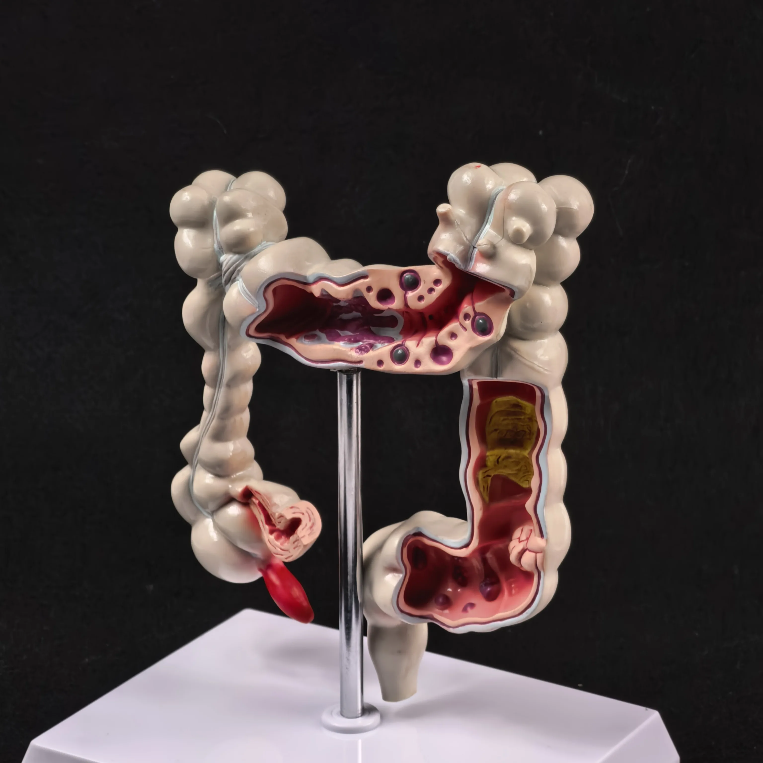 

Анатомическая модель медицинского органа толстой кишки человека для образования и изучения анатомии патологических заболеваний