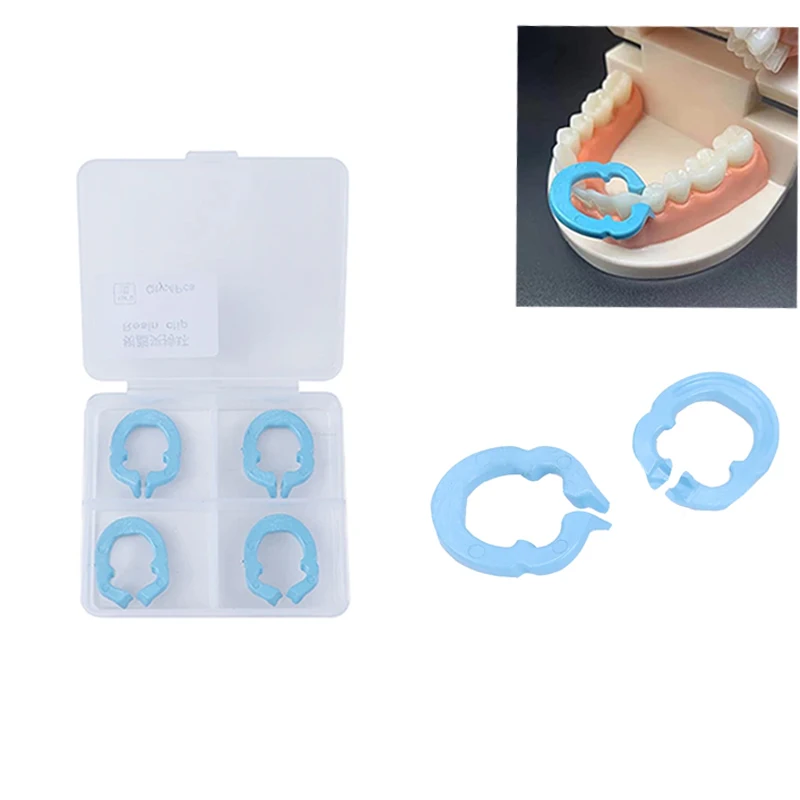 

4PCS Dental Resin Clamping Ring Separator Ring Dental Rubber Dam Clamp Resin Matrix Ring Clips Matrix Fixed Clamp Autoclavable