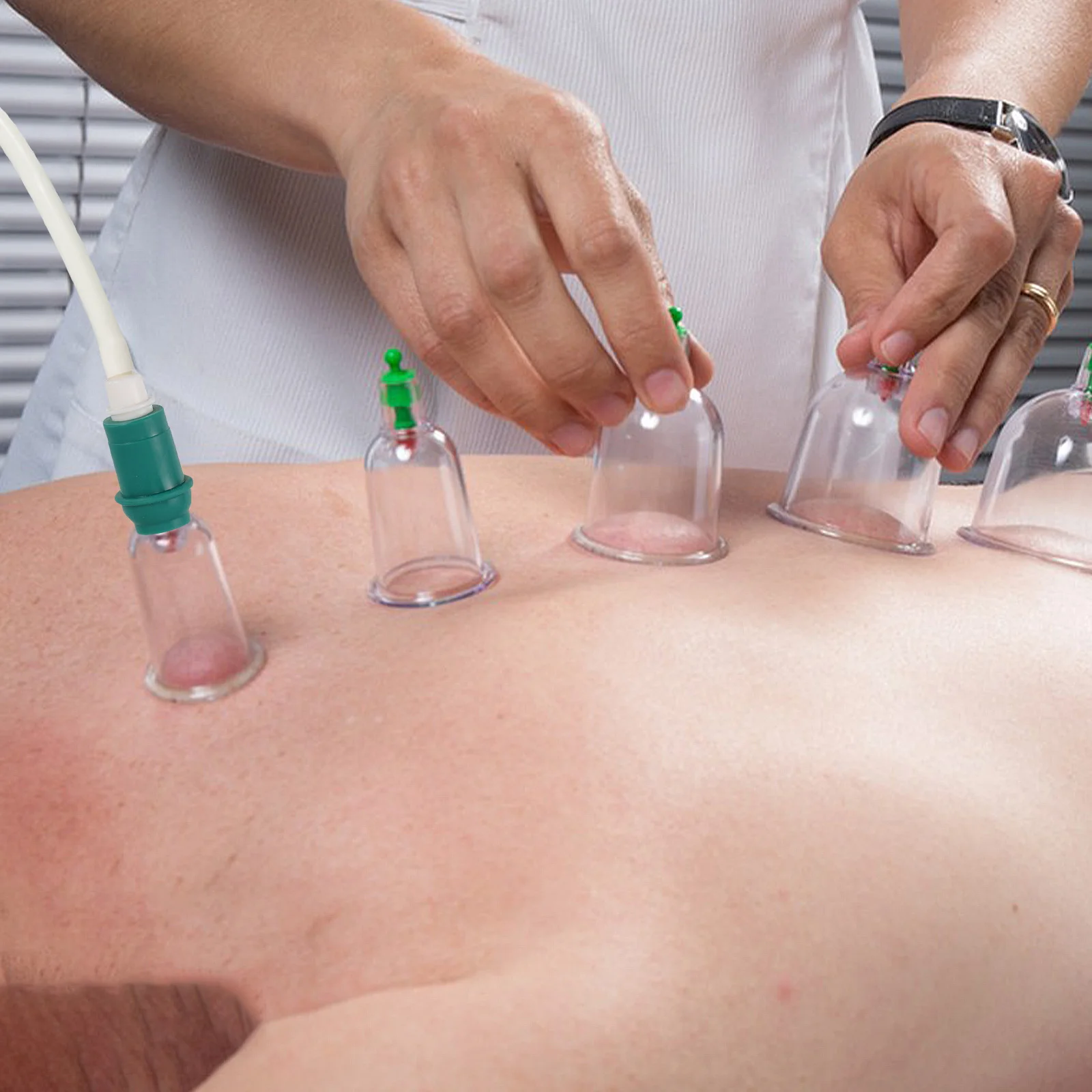 

Cupping Device Connecting Tube Extended Suction Tubing Straw Pipe Rubber Vacuum Hose Suitable Various Devices Massage Relaxation