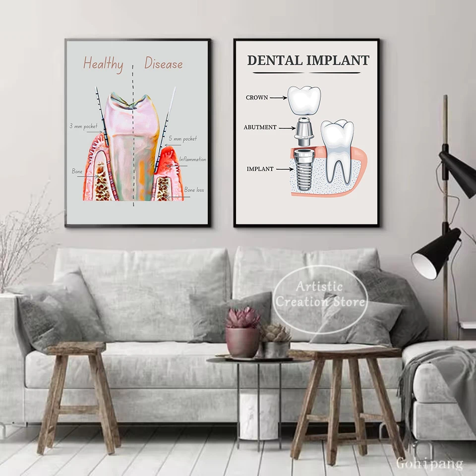 Dentist Tooth Anatomy Periodontal Gum Disease Education Poster Canvas Painting Wall Art Pictures Home Dental Office Decor Gift